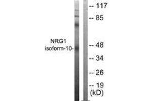 Western blot analysis of extracts from SKOV3 cells, using NRG1 isoform-10 Antibody. (NRG1 Isoform-10 (AA 1-50) anticorps)