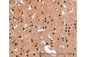 Immunohistochemistry of Human brain  using RPSA Polyclonal Antibody at dilution of 1:60 (RPSA/Laminin Receptor anticorps)