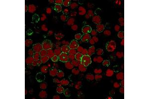 Immunofluorescence staining of MOLT-4 cells using CD2 Mouse Monoclonal Antibody (BH1) followed by goat anti-Mouse IgG conjugated to CF488 (green). (CD2 anticorps)