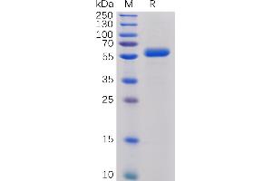 Human CTLA-4 Protein, mFc-His Tag on SDS-PAGE under reducing condition. (CTLA4 Protein (AA 36-161) (mFc-His Tag))