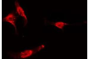 ABIN6275160 staining  Hela cells by IF/ICC. (GRB2 anticorps  (C-Term))