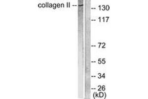 Western blot analysis of extracts from COLO205 cells, using Collagen II Antibody. (COL2 anticorps  (AA 101-150))
