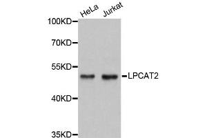 Western blot analysis of extracts of various cell lines, using LPCAT2 antibody (ABIN5972766) at 1:3000 dilution. (LPCAT2 anticorps)