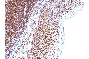 Formalin-fixed, paraffin-embedded human Tonsil stained with SUMO-1 Monoclonal Antibody (SUMO1/1188) (SUMO1 anticorps)