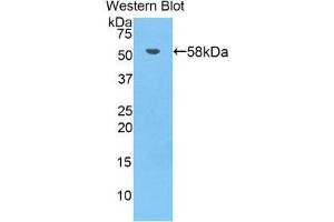 Western Blotting (WB) image for anti-Bruton Agammaglobulinemia tyrosine Kinase (BTK) (AA 396-659) antibody (ABIN1858180) (BTK anticorps  (AA 396-659))