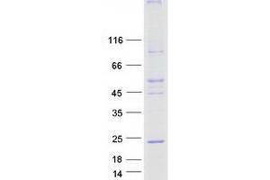 Validation with Western Blot (TMEM97 Protein (Myc-DYKDDDDK Tag))