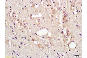 Immunohistochemistry (Paraffin-embedded Sections) (IHC (p)) image for anti-Intercellular Adhesion Molecule 1 (ICAM1) (AA 201-300) antibody (ABIN670806)