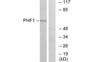 Western blot analysis of extracts from HeLa cells, using PHF1 antibody. (PHF1 anticorps  (Internal Region))