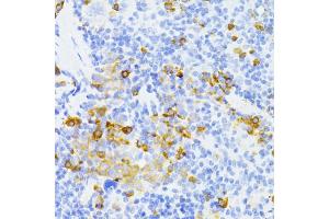 Immunohistochemistry of paraffin-embedded mouse spleen using MMP2 antibody (ABIN5973678) at dilution of 1/100 (40x lens). (MMP2 anticorps)