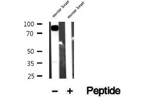 Western blot analysis of extracts of mouse heart tissue, using Aconitase 2 antibody. (ACO2 anticorps  (Internal Region))