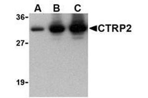 Image no. 1 for anti-C1q and Tumor Necrosis Factor Related Protein 2 (C1QTNF2) antibody (ABIN207843) (C1QTNF2 anticorps)
