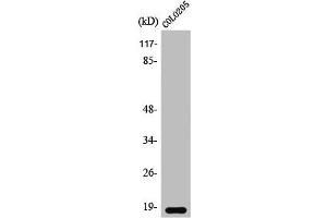 Western Blot analysis of COLO205 cells using TCEAL1 Polyclonal Antibody (TCEAL1 anticorps  (Internal Region))