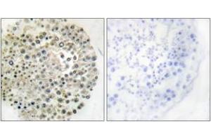 Immunohistochemistry (IHC) image for anti-Tripartite Motif Containing 16 (TRIM16) (AA 31-80) antibody (ABIN2889360) (TRIM16 anticorps  (AA 31-80))