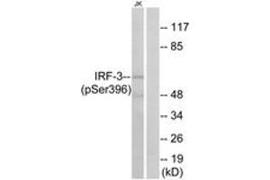 Western blot analysis of extracts from Jurkat cells treated with EGF 200ng/ml 30', using IRF-3 (Phospho-Ser396) Antibody. (IRF3 anticorps  (pSer396))