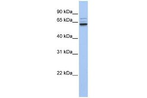 GEFT antibody used at 1 ug/ml to detect target protein. (ARHGEF25/GEFT anticorps  (C-Term))