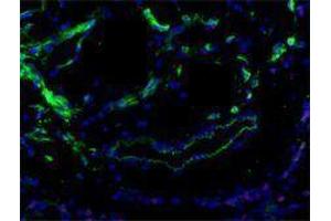 Immunofluorescence (IF) image for anti-Fms-Related Tyrosine Kinase 4 (FLT4) antibody (ABIN2665457) (FLT4 anticorps)