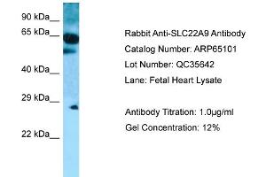 Western Blotting (WB) image for anti-Solute Carrier Family 22 (Organic Anion Transporter), Member 9 (SLC22A9) (C-Term) antibody (ABIN2790043) (SLC22A9 anticorps  (C-Term))