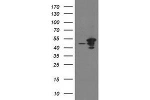 Western Blotting (WB) image for anti-ADP-Ribosylation Factor GTPase Activating Protein 1 (ARFGAP1) antibody (ABIN1496684) (ARFGAP1 anticorps)