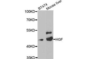 Western blot analysis of extracts of various cell lines, using HGF antibody. (HGF anticorps  (AA 30-285))