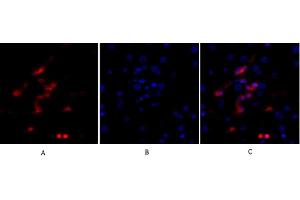 Immunofluorescence analysis of human liver tissue. (p53 anticorps)