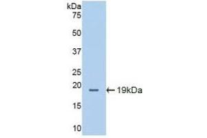 Detection of Recombinant ICAM1, Mouse using Polyclonal Antibody to Intercellular Adhesion Molecule 1 (ICAM1) (ICAM1 anticorps  (AA 328-465))