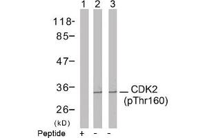 Image no. 2 for anti-Cyclin-Dependent Kinase 2 (CDK2) (pThr160) antibody (ABIN196845) (CDK2 anticorps  (pThr160))