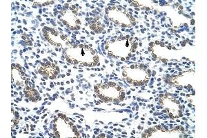 Cytokeratin 18 antibody was used for immunohistochemistry at a concentration of 4-8 ug/ml to stain Alveolar cells (arrows) in Human Lung. (Cytokeratin 18 anticorps  (C-Term))