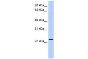 Image no. 1 for anti-Activating Transcription Factor 3 (ATF3) (AA 71-120) antibody (ABIN6740496) (ATF3 anticorps  (AA 71-120))