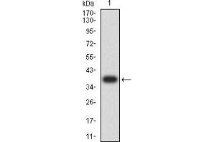 ALDH1A1 anticorps  (AA 1-110)