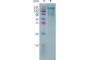 Human P Protein, His Tag on SDS-PAGE under reducing condition. (PCDH18 Protein (AA 28-697) (His tag))