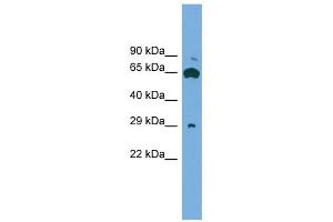 GLIPR1L1 antibody used at 1 ug/ml to detect target protein. (GLIPR1L1 anticorps  (Middle Region))