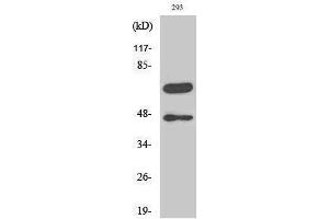 Western Blotting (WB) image for anti-Caspase 8 (CASP8) (Asp384), (cleaved) antibody (ABIN3181767) (Caspase 8 anticorps  (Asp384, cleaved))