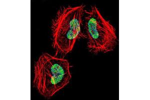 Immunofluorescence (IF) image for anti-Histone Deacetylase 4 (HDAC4) antibody (ABIN2997490) (HDAC4 anticorps)