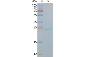 Human C-Nanodisc, Flag Tag on SDS-PAGE (CMTM6 Protéine)
