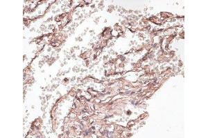 Immunohistochemistry of paraffin-embedded Human lung using COL6A1 Polyclonal Antibody at dilution of 1:100 (40x lens). (COL6A1 anticorps)