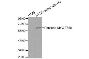 Western blot analysis of extracts from HT29 cells untreated or treated with UV, using phospho-MYC-T358 antibody (ABIN2988193). (c-MYC anticorps  (pThr358))
