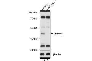 Western blot analysis of extracts from normal (control) and MK4 knockout (KO) HeLa cells, using MK4 antibody (ABIN7268641) at 1:1000 dilution. (MAP2K4 anticorps  (AA 300-399))