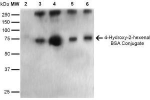 Western Blot analysis of 4-hydroxy-2-hexanal-BSA Conjugate showing detection of 67 kDa 4-hydroxy-2-hexenal-BSA using Mouse Anti-4-hydroxy-2-hexenal Monoclonal Antibody, Clone 6F10 . (4-Hydroxy-2-Hexenal (4-HHE) anticorps (PE))