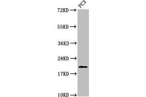 Western Blot Positive WB detected in: PC-3 whole cell lysate All lanes: HIST1H1D antibody at 1 μg/mL Secondary Goat polyclonal to rabbit IgG at 1/50000 dilution Predicted band size: 23 kDa Observed band size: 23 kDa (Histone H1.3 anticorps  (pThr146))