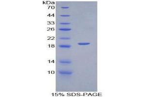 SDS-PAGE analysis of Mouse PECAM1 Protein. (CD31 Protéine)