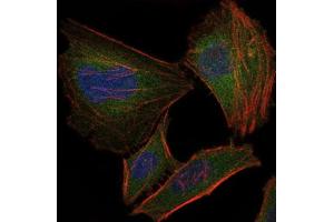 Immunofluorescence (IF) image for anti-Fast Skeletal Troponin I (TNNI2) antibody (ABIN1107197) (TNNI2 anticorps)