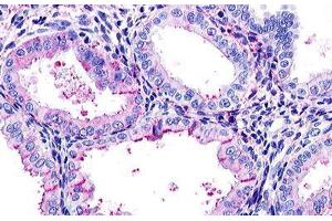 Image no. 1 for anti-Relaxin/insulin-Like Family Peptide Receptor 1 (RXFP1) (N-Term) antibody (ABIN1049306) (RXFP1 anticorps  (N-Term))