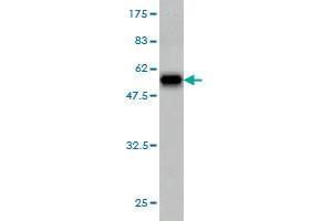 Western Blotting (WB) image for anti-Proteasome Subunit alpha  7 (PSMA7) (AA 1-248) antibody (ABIN562474)