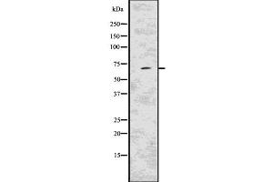 Western blot analysis of KCND2 using MCF7 whole  lysates. (KCND2 anticorps  (C-Term))