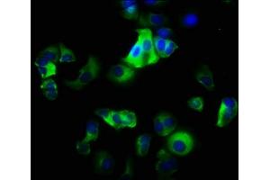 Immunofluorescence staining of MCF-7 cells with ABIN7156430 at 1:200, counter-stained with DAPI. (ITGA2 anticorps  (AA 188-365))