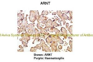 Researcher: Hiten D. (ARNT anticorps  (C-Term))