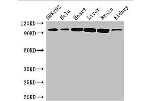 Western Blot Positive WB detected in: HEK293 whole cell lysate, Hela whole cell lysate, Mouse heart tissue, Mouse liver tissue, Mouse brain tissue, Mouse kidney tissue All lanes: CDH2 antibody at 3 μg/mL Secondary Goat polyclonal to rabbit IgG at 1/50000 dilution Predicted band size: 100, 98 kDa Observed band size: 100 kDa (N-Cadherin anticorps  (AA 746-906))