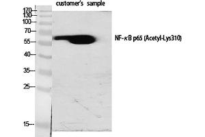 Western Blot analysis of various cells using Acetyl-NFκB-p65 (K310) Polyclonal Antibody diluted at 1:1000. (NF-kB p65 anticorps  (acLys310))