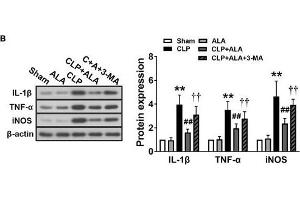 Western Blotting (WB) image for anti-Interleukin 1, beta (IL1B) (AA 101-200) antibody (ABIN728503)