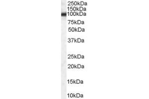 Image no. 1 for anti-Heat Shock Protein 90kDa beta (Grp94), Member 1 (HSP90B1) (Internal Region) antibody (ABIN374699) (GRP94 anticorps  (Internal Region))